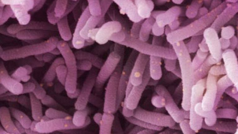 Bacterias-lácticas 