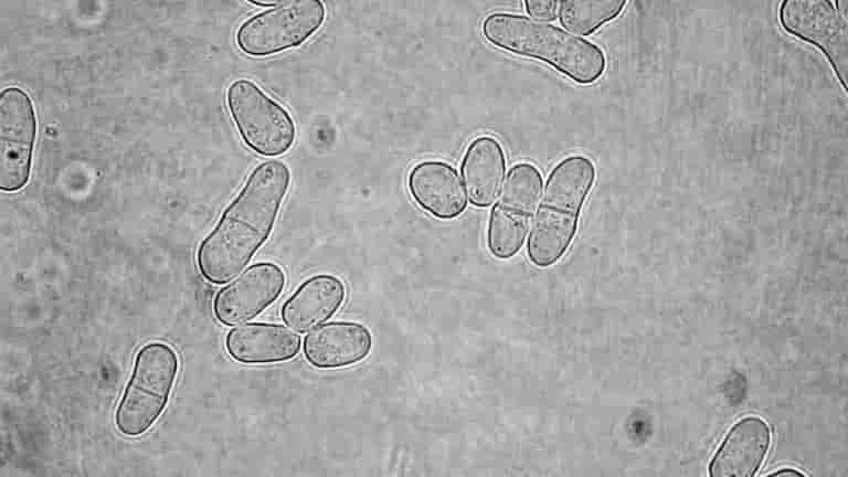 ▷ ¿Qué es la levadura y cómo funciona? 3 levadura-microscopio-40x