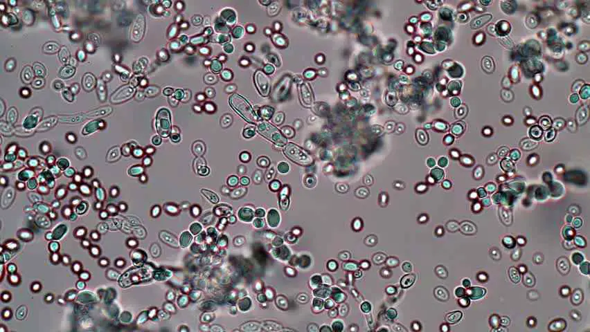 ▷ ¿Qué es la levadura y cómo funciona? 4 levadura-microscopio